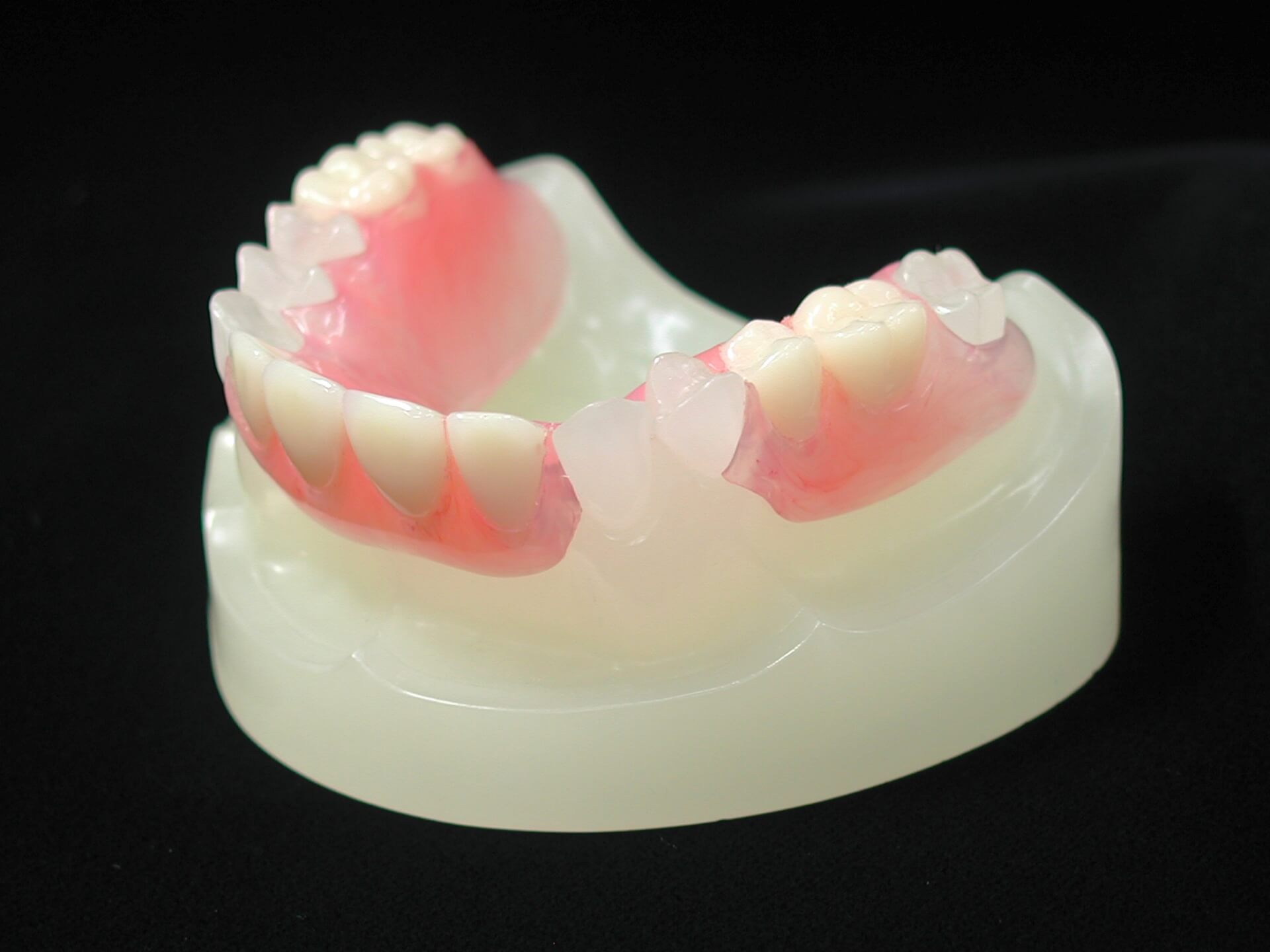 一般的な入れ歯と異なる審美歯科の入れ歯の特徴とは？