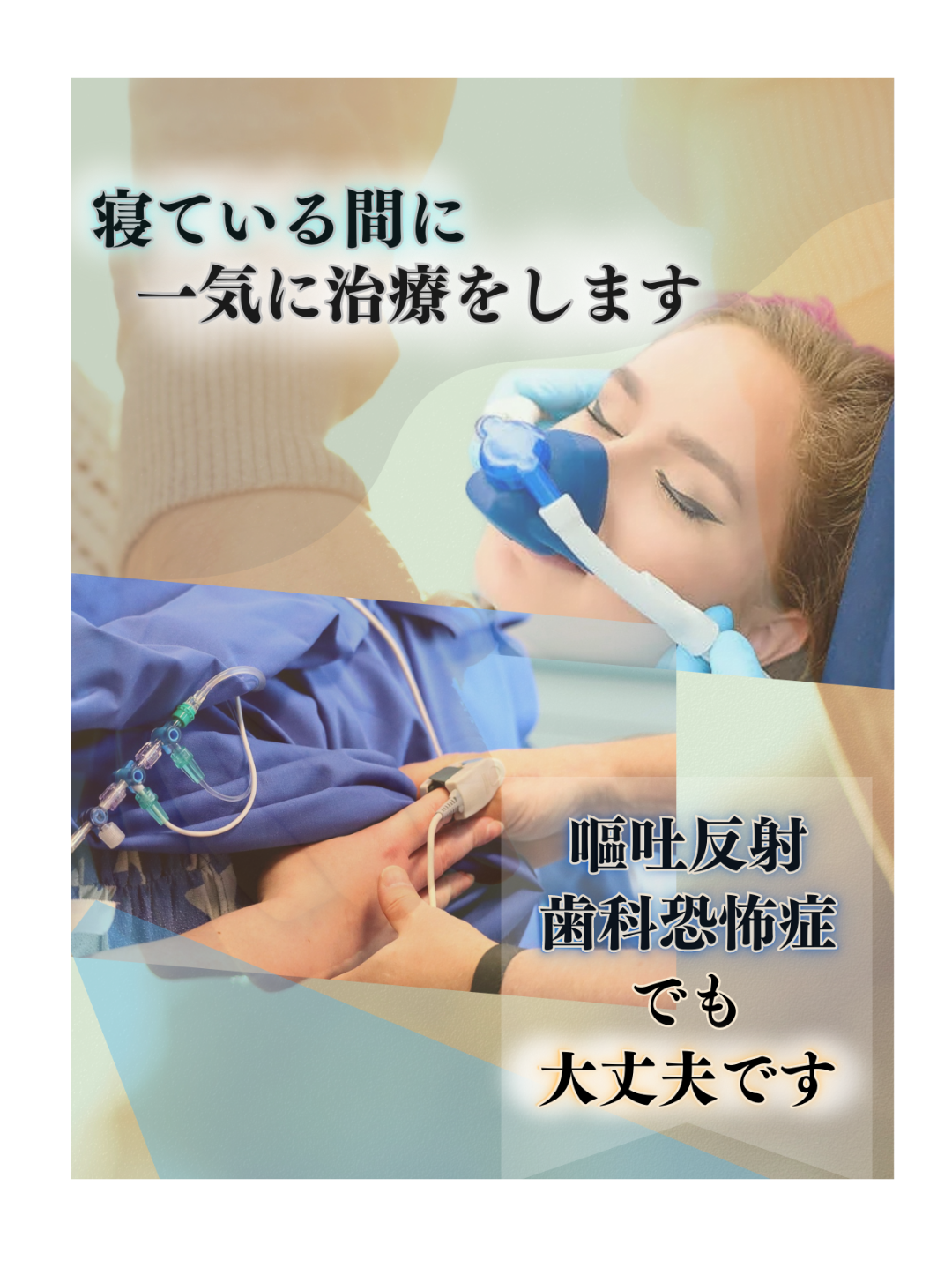 静脈 麻酔 全身 麻酔 違い