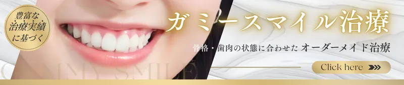 ガミースマイル治療バナー｜池袋の歯医者・歯科「Lily Smile Dental Clinic」