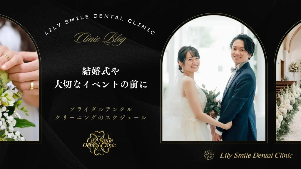 結婚式や大切なイベントの前に|ブライダルデンタル・クリーニングのスケジュール